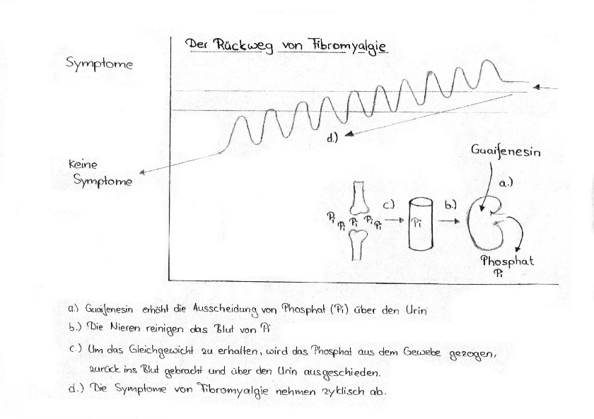Bild zum R�ckgang der Fibromyalgie